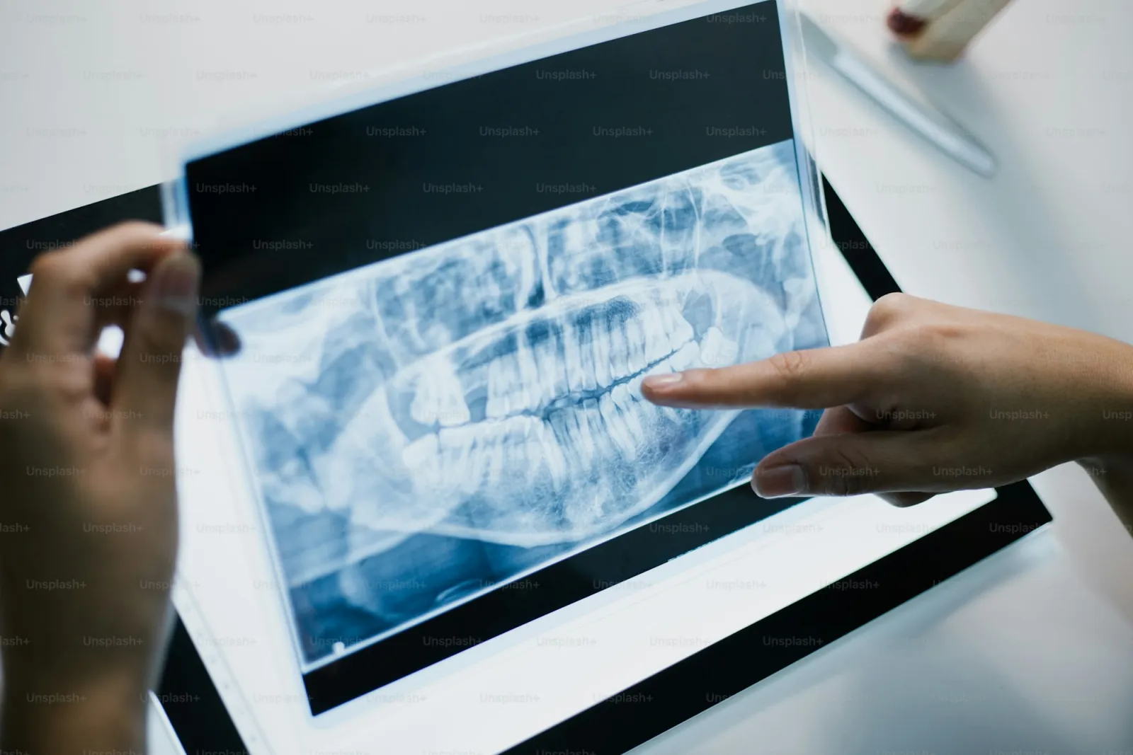 Dental X-ray images on a light box in a dental office